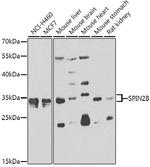 SPIN2 Polyclonal Antibody
