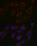 BCAT2 Polyclonal Antibody