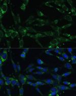 Calpain 5 Polyclonal Antibody
