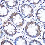 WISP2 Polyclonal Antibody