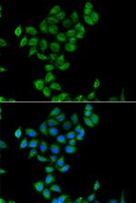 COQ3 Polyclonal Antibody