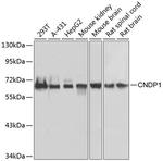 CNDP1 Polyclonal Antibody