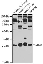 STK19 Polyclonal Antibody