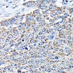 ETFA Polyclonal Antibody
