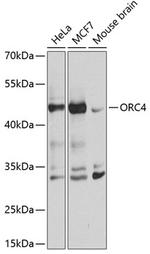 ORC4 Antibody in Western Blot (WB)