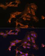 MEK3 Antibody in Immunocytochemistry (ICC/IF)