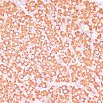 MEK3 Antibody in Immunohistochemistry (Paraffin) (IHC (P))
