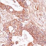 MEK3 Antibody in Immunohistochemistry (Paraffin) (IHC (P))