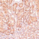 MEK3 Antibody in Immunohistochemistry (Paraffin) (IHC (P))