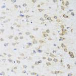 STRN Antibody in Immunohistochemistry (Paraffin) (IHC (P))
