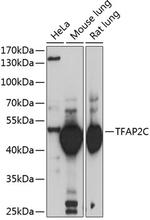 AP2 gamma Polyclonal Antibody