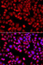 p21 ARC Polyclonal Antibody