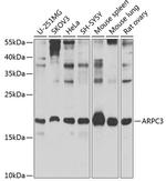 p21 ARC Antibody in Western Blot (WB)