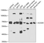 ACAD9 Polyclonal Antibody