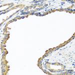 NYX Polyclonal Antibody