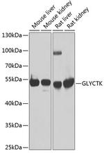 GLYCTK Polyclonal Antibody