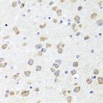 CHD1 Antibody in Immunohistochemistry (Paraffin) (IHC (P))