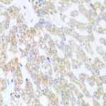 CHD1 Polyclonal Antibody