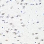CHD1 Antibody in Immunohistochemistry (Paraffin) (IHC (P))
