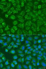 eIF2b alpha Polyclonal Antibody