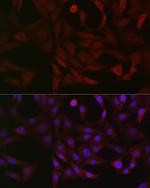 PFKP Polyclonal Antibody