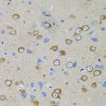 PFKP Antibody in Immunohistochemistry (Paraffin) (IHC (P))