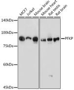 PFKP Antibody in Western Blot (WB)