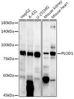 PLOD1 Polyclonal Antibody