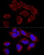 MTX2 Antibody in Immunocytochemistry (ICC/IF)