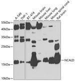 NCALD Antibody in Western Blot (WB)