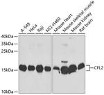 Cofilin 2 Antibody in Western Blot (WB)