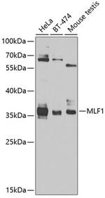 MLF1 Antibody in Western Blot (WB)