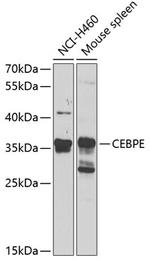 C/EBP epsilon Polyclonal Antibody
