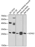 UCHL3 Polyclonal Antibody