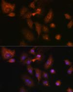 RSPO1 Polyclonal Antibody