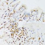 ANR52 Antibody in Immunohistochemistry (Paraffin) (IHC (P))