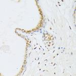 ANR52 Polyclonal Antibody