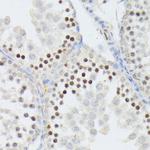 ANR52 Antibody in Immunohistochemistry (Paraffin) (IHC (P))