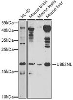 UBE2NL Antibody in Western Blot (WB)