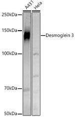 Desmoglein 3 Polyclonal Antibody