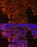 GHRHR Polyclonal Antibody