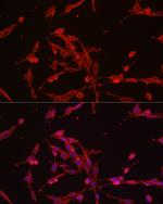 HK3 Antibody in Immunocytochemistry (ICC/IF)