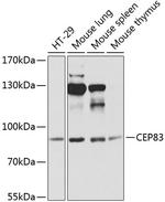 CEP83 Polyclonal Antibody