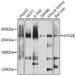ATG2B Polyclonal Antibody