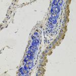GAS6 Polyclonal Antibody