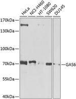 GAS6 Antibody in Western Blot (WB)