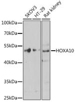 HOXA10 Antibody in Western Blot (WB)
