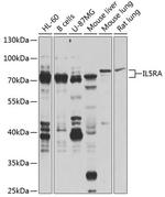 IL5RA Polyclonal Antibody