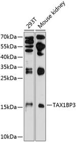 TAX1BP3 Polyclonal Antibody