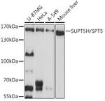 SPT5 Polyclonal Antibody